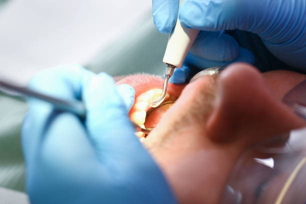 Best Broken Tooth Emergency  in Sylvester, GA