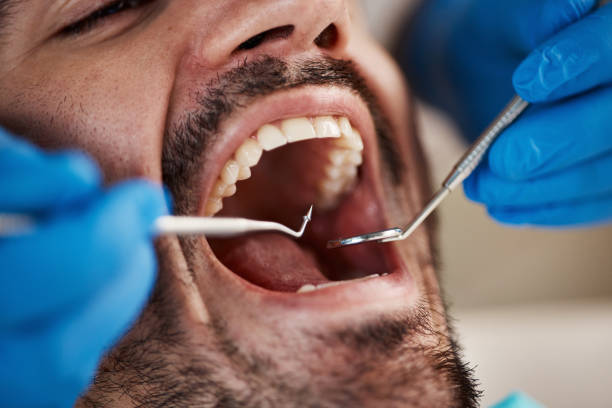 Best Tooth Infection Emergency Dentist  in Sylvester, GA