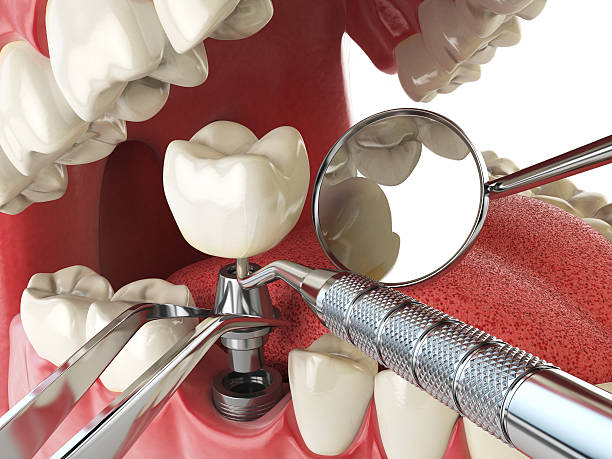 Best Cracked Tooth Emergency Dentist  in Sylvester, GA